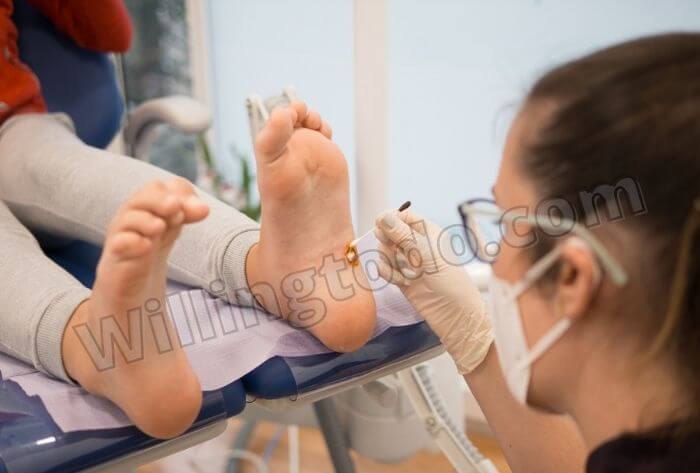 See podiatrist to treat plantar warts like verruca