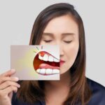 Cuts on Gums