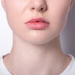 Uneven Lips