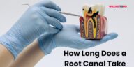 How Long Does a Root Canal Take