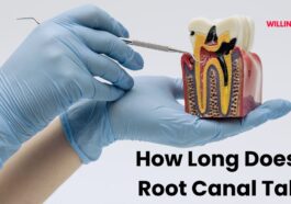 How Long Does a Root Canal Take