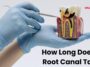 How Long Does a Root Canal Take