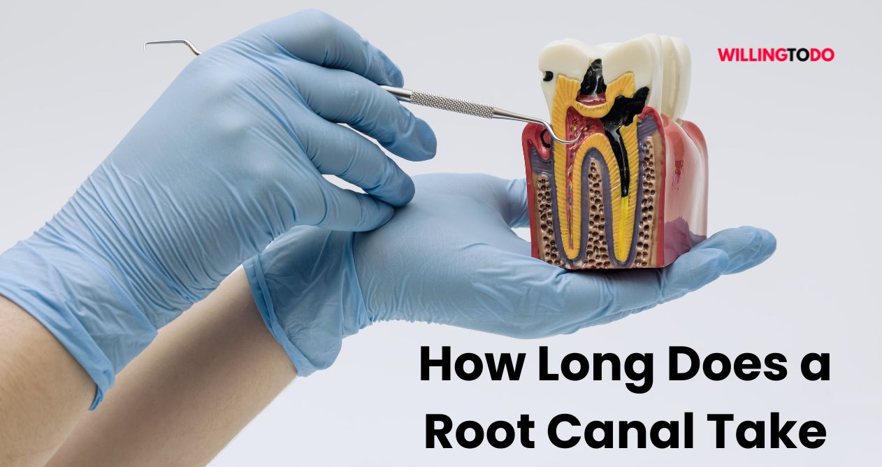 How Long Does a Root Canal Take